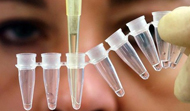 DNA Testing Periodontal Disease
